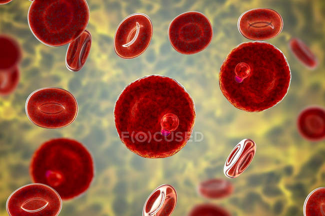 Protozoos de Plasmodium malariae en los vasos sanguíneos, ilustración por ordenador
. - foto de stock