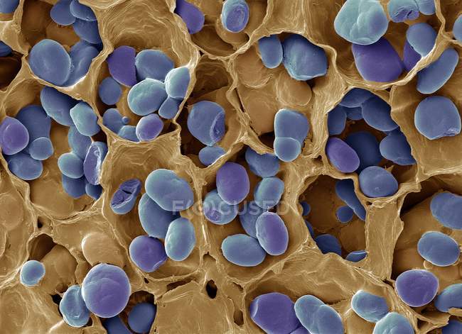 Micrografia eletrônica de varredura colorida de grãos de amido em sementes de leguminosas . — Fotografia de Stock