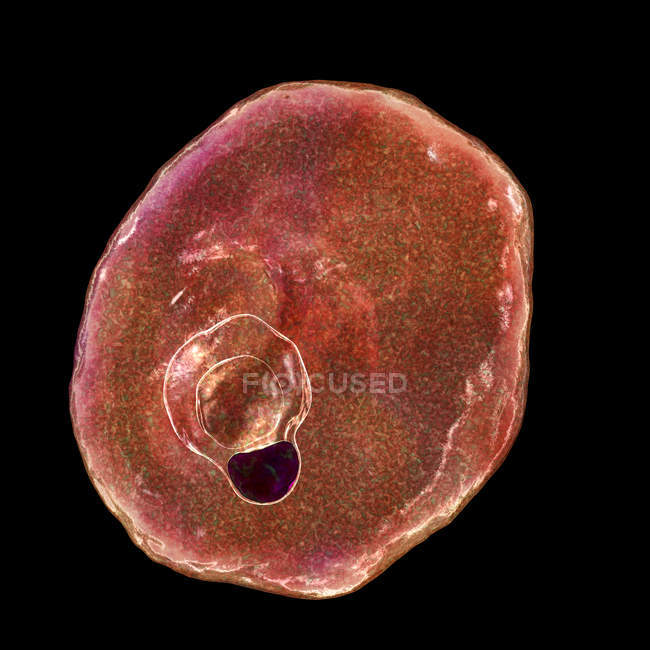 Plasmodium ovale protozoan, ilustración por ordenador
. - foto de stock