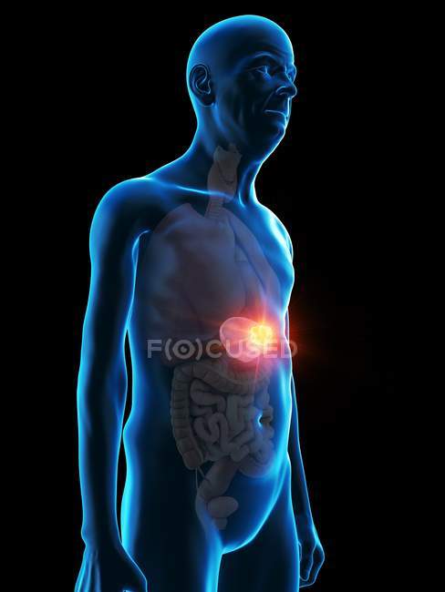 Цифровая иллюстрация анатомии пожилого человека, показывающая опухоль селезенки
. — стоковое фото