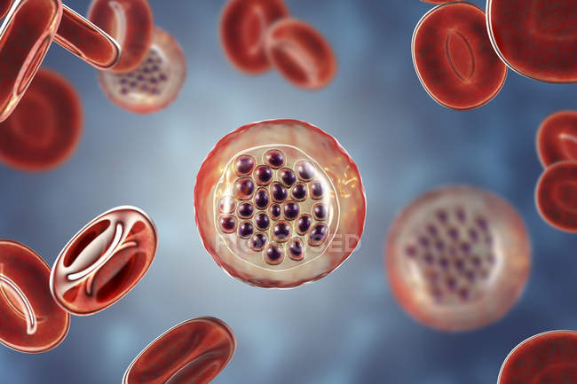 Protozoários Plasmodium falciparum, agente causador da malária tropical nos glóbulos vermelhos, ilustração digital
. — Fotografia de Stock