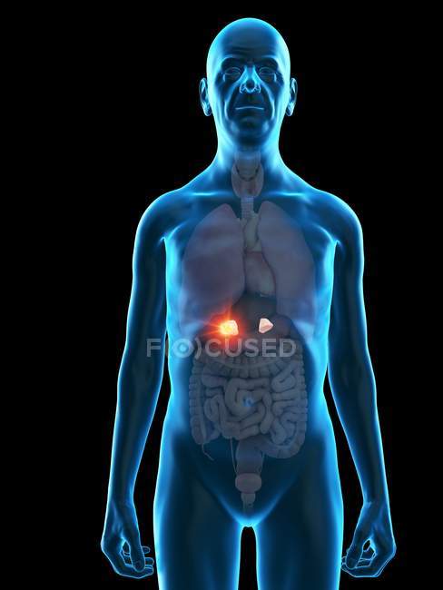 Ilustração digital da anatomia do homem sênior mostrando tumor da glândula adrenal . — Fotografia de Stock
