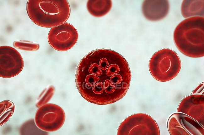 Protozoos de Plasmodium malariae y glóbulos rojos en los vasos sanguíneos, ilustración por ordenador
. - foto de stock