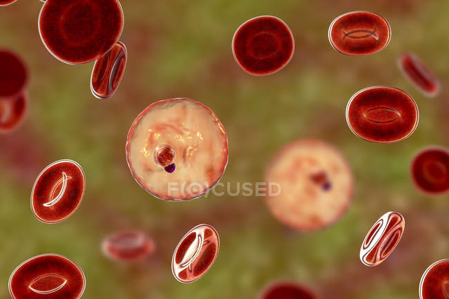 Плазмодієва малярія в кровоносних судинах, комп'ютерна ілюстрація . — стокове фото
