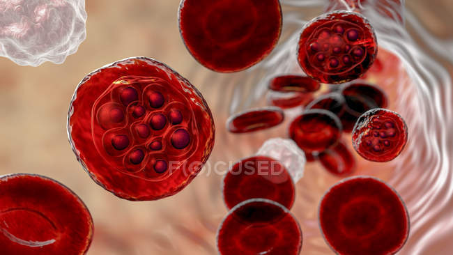 Protozoários de Plasmodium vivax dentro do vaso sanguíneo, ilustração digital . — Fotografia de Stock