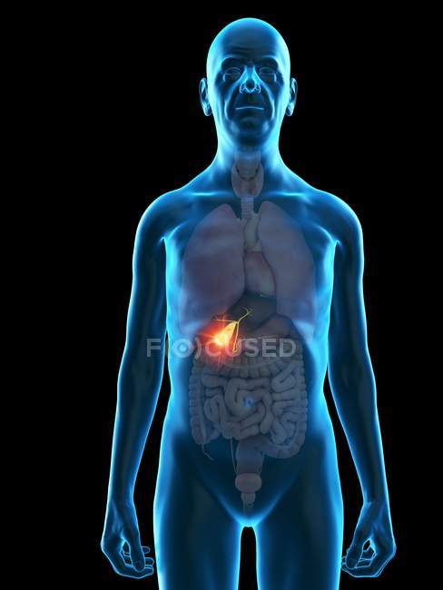 Illustrazione digitale dell'anatomia dell'uomo anziano che mostra il tumore della cistifellea . — Foto stock