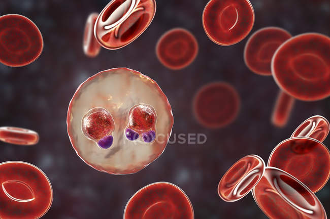 Protozoan Plasmodium falciparum, causative agent of tropical malaria in red blood cells, digital illustration. — Stock Photo