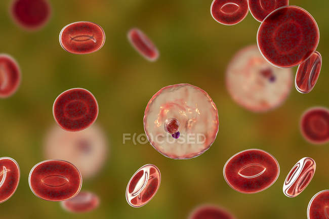 Plasmodium malariae protozoaires dans les vaisseaux sanguins, illustration par ordinateur
. — Photo de stock