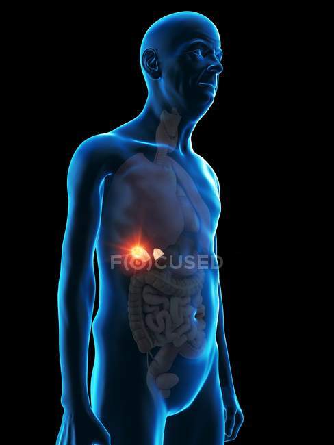 Ilustración digital de la anatomía del hombre mayor que muestra el tumor de la glándula suprarrenal . - foto de stock