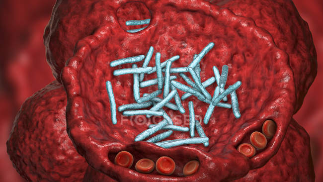 Illustration informatique de bacilles en forme de bâtonnet à l'intérieur de l'alvéole du poumon, causant une infection des voies respiratoires inférieures et une pneumonie bactérienne. — Photo de stock