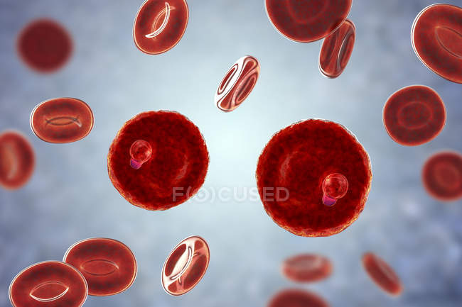 Plasmodium malariae protozoa in vaso sanguigno, illustrazione al computer
. — Foto stock