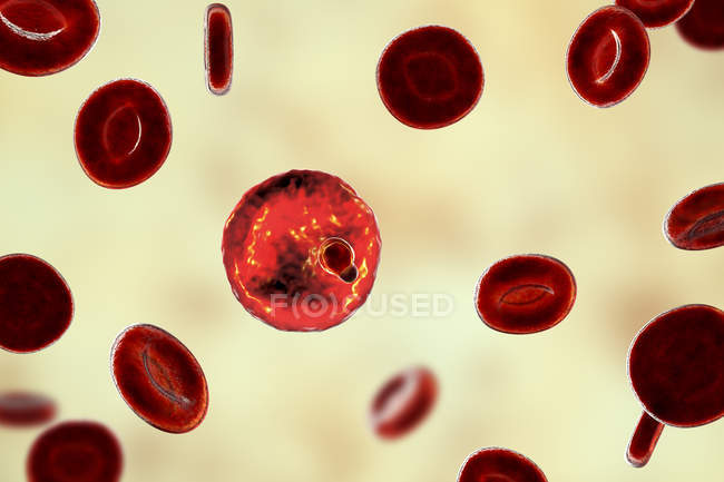 Plasmodium malariae Protozoen und rote Blutkörperchen in Blutgefäßen, Computerillustration. — Stockfoto