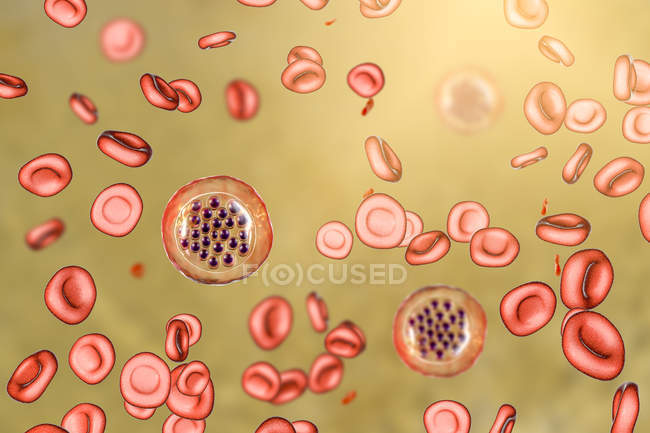 Protozoa Plasmodium falciparum, causative agent of tropical malaria in Red Blood cell, digital illustration. — стокове фото