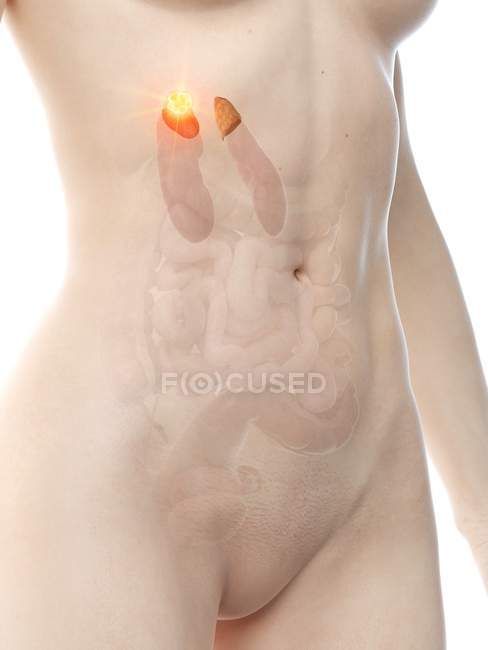Жіноче тіло з раком наднирників, комп'ютерна ілюстрація. — стокове фото