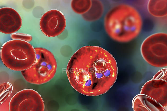 Protozoa plasmodium falciparum, Erreger der tropischen Malaria in roten Blutkörperchen, digitale Illustration. — Stockfoto