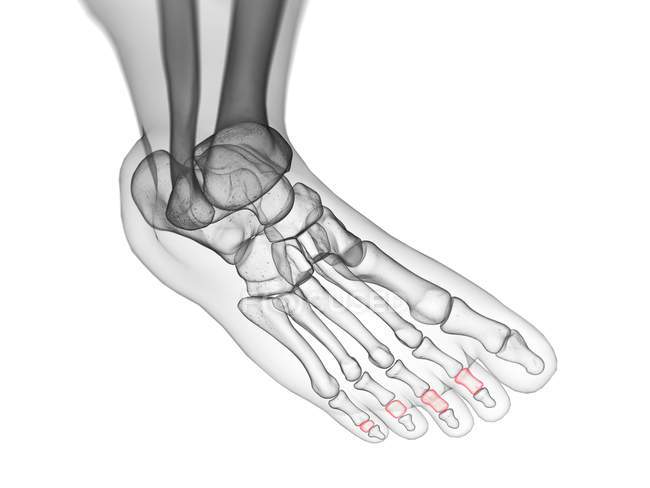 Ossos da falange média em raio-x ilustração computadorizada do pé humano . — Fotografia de Stock
