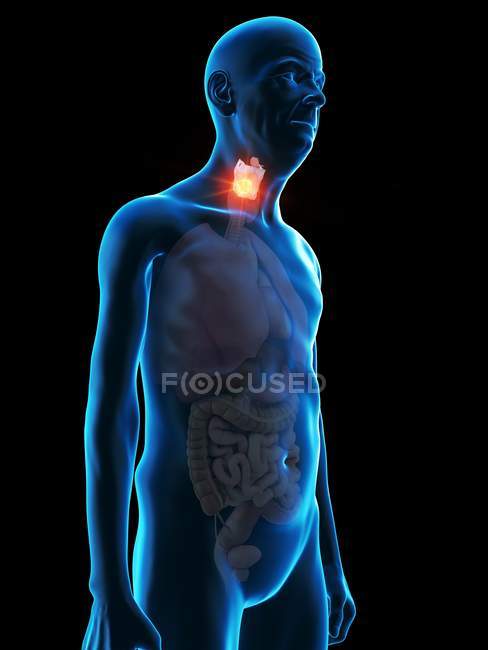 Ilustración digital de la anatomía del hombre mayor que muestra tumor de laringe . - foto de stock