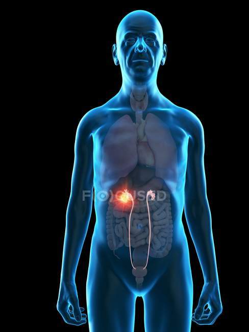Digitale Illustration der Anatomie eines älteren Mannes mit Harnleiter-Tumor. — Stockfoto