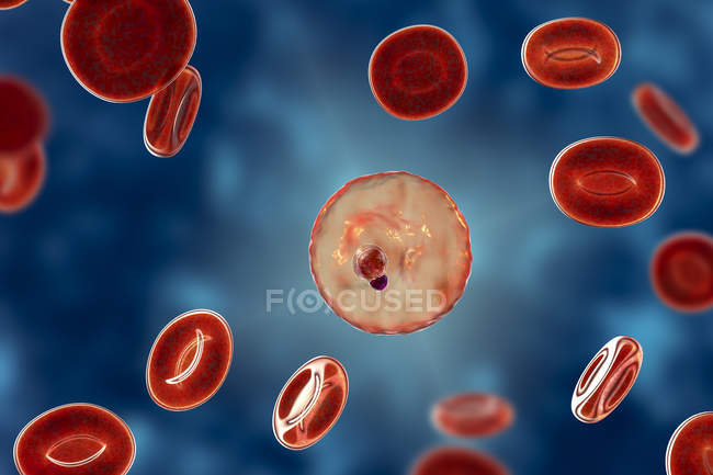 Plasmodium malariae protozoan e globuli rossi nei vasi sanguigni, illustrazione al computer
. — Foto stock