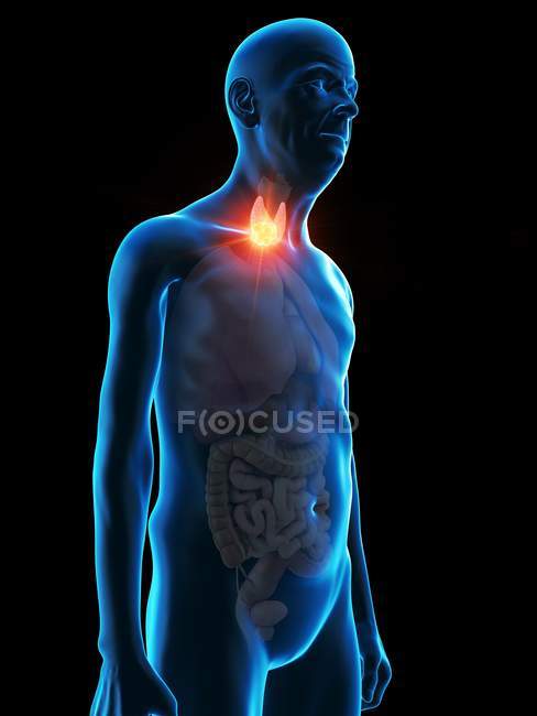 Digital illustration of senior man anatomy showing thyroid gland tumour. — Stock Photo