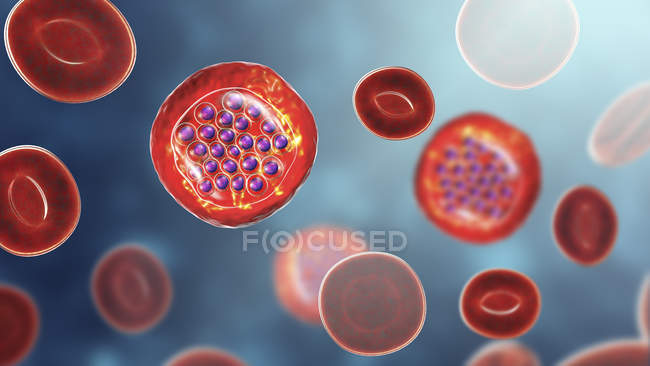 Protozoi Plasmodium falciparum, agente causale della malaria tropicale nei globuli rossi, illustrazione digitale . — Foto stock