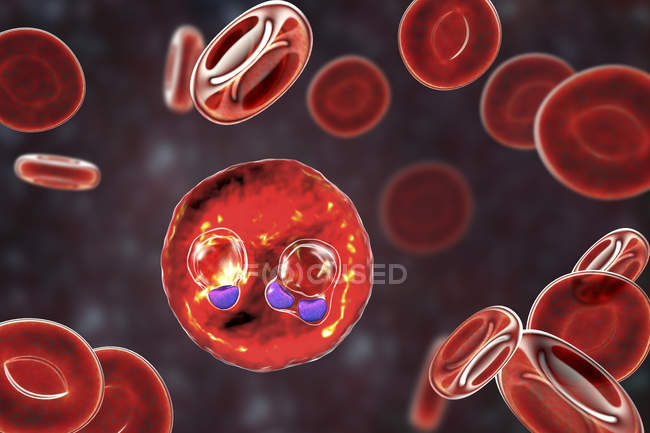 Protozoo Plasmodium falciparum, agente causal de la malaria tropical en los glóbulos rojos, ilustración digital . - foto de stock