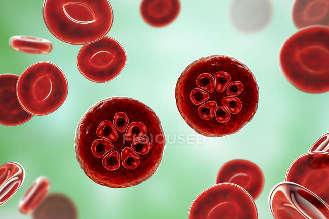 Protozoos de Plasmodium malariae en los vasos sanguíneos, ilustración por ordenador . - foto de stock