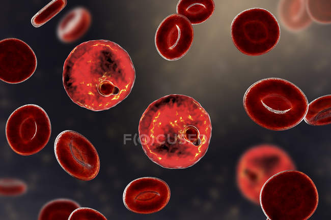 Protozoos de Plasmodium malariae en los vasos sanguíneos, ilustración por ordenador
. - foto de stock