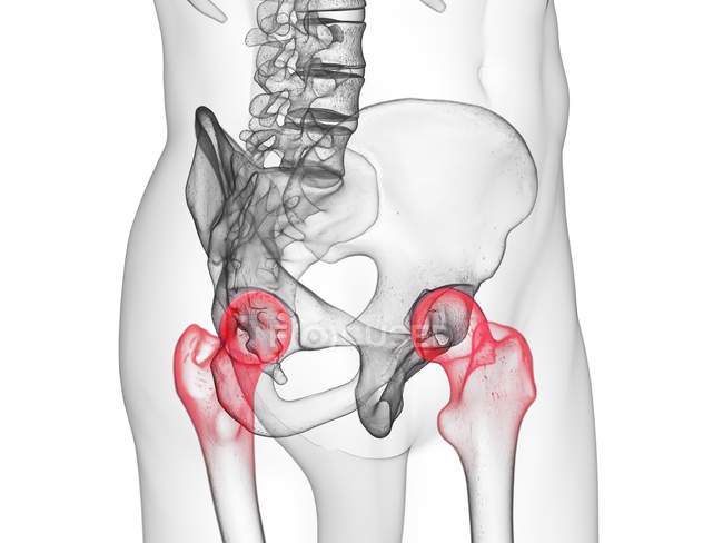 Silueta transparente del cuerpo humano con articulaciones de cadera visibles y coloreadas, ilustración por computadora . - foto de stock
