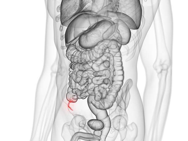 Corps masculin anatomique avec appendice coloré, illustration par ordinateur . — Photo de stock