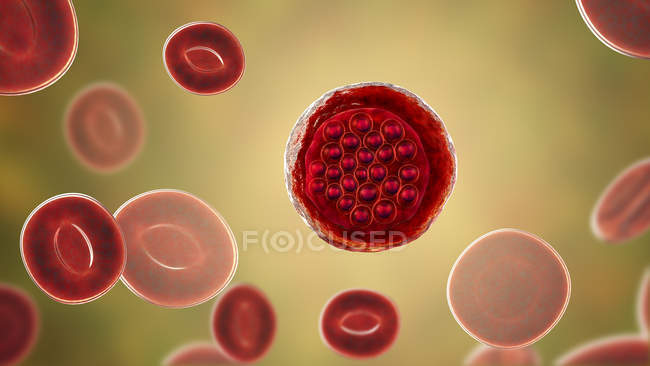 Protozoen-Plasmodium falciparum, Erreger der tropischen Malaria in roten Blutkörperchen, digitale Illustration. — Stockfoto