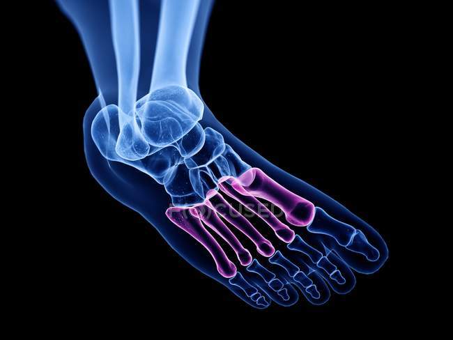 Ossa metatarsali nell'illustrazione computerizzata a raggi X del piede umano . — Foto stock