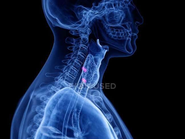 Abstract male silhouette with visible parathyroid glands, computer illustration. — Stock Photo