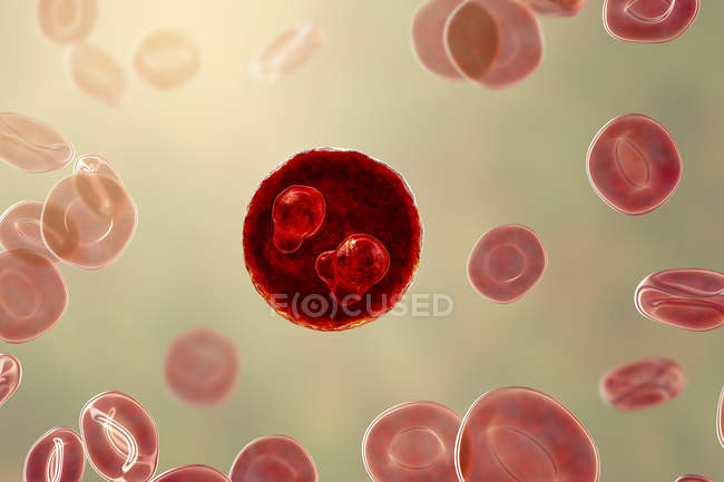 Protozoan Plasmodium falciparum, возбудитель тропической малярии в эритроцитах, цифровая иллюстрация . — стоковое фото