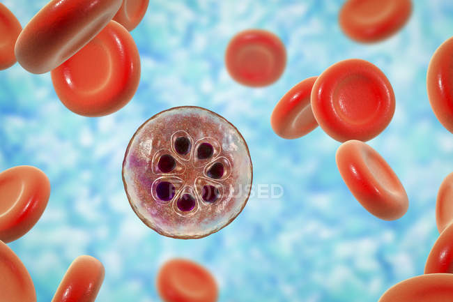 Protozoos de Plasmodium malariae y glóbulos rojos en los vasos sanguíneos, ilustración por ordenador . - foto de stock