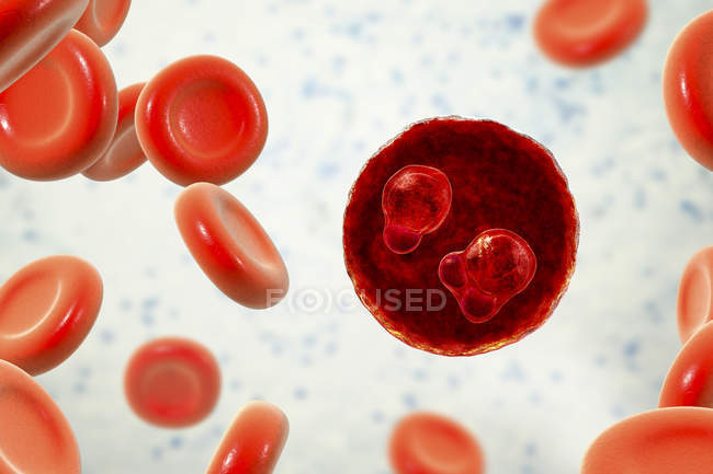 Protozoo Plasmodium falciparum, agente causal de la malaria tropical en los glóbulos rojos, ilustración digital
. - foto de stock