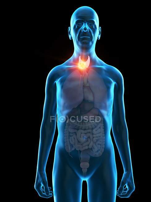 Illustration numérique de l'anatomie de l'homme âgé montrant une tumeur de la glande thyroïde . — Photo de stock