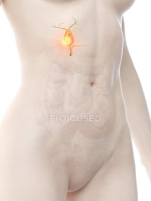 Cuerpo femenino con cáncer de vesícula, ilustración digital conceptual . - foto de stock