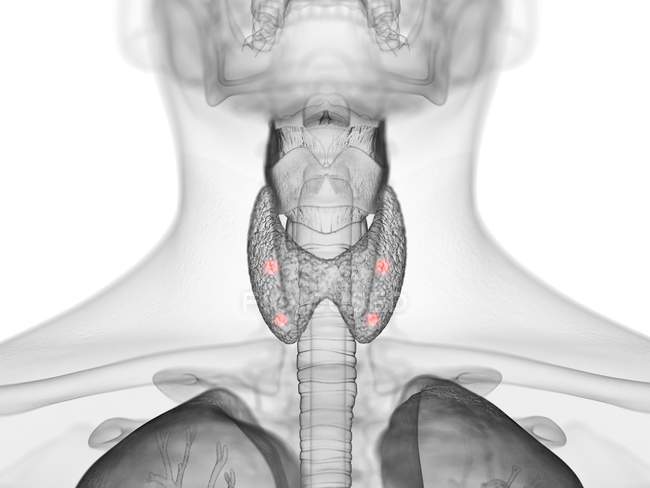 Silueta masculina abstracta con glándulas paratiroideas visibles, ilustración por ordenador . - foto de stock
