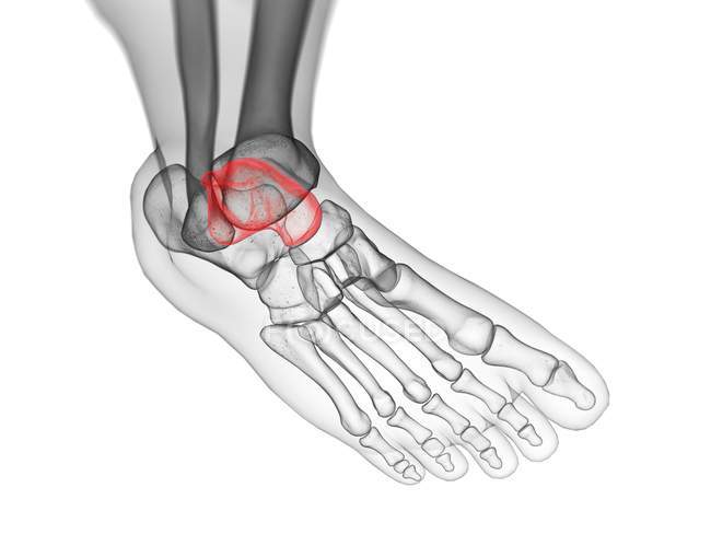 Talusknochen in der Röntgencomputerdarstellung des menschlichen Fußes. — Stockfoto