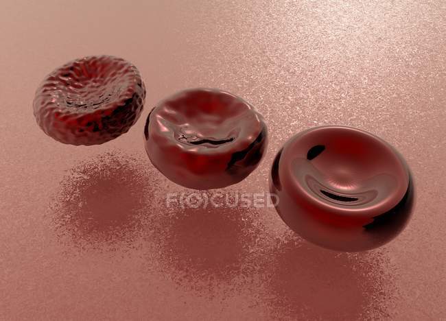 Dead, dying and healthy red blood cells, conceptual digital illustration. — Stock Photo