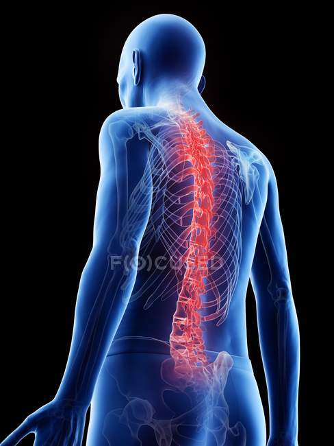 Illustrazione anatomica digitale della schiena dolorosa dell'uomo anziano . — Foto stock