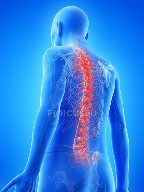 Ilustração anatômica digital de costas dolorosas de homem sênior . — Fotografia de Stock