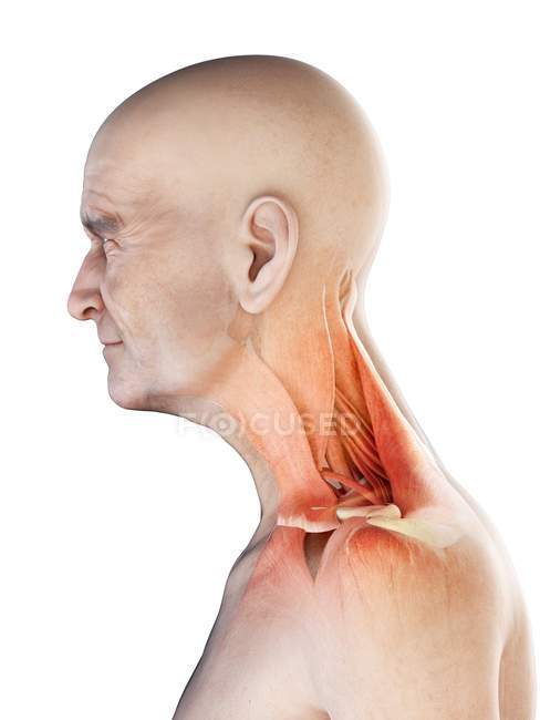 Digitale anatomische Illustration der Nackenmuskulatur eines älteren Mannes. — Stockfoto