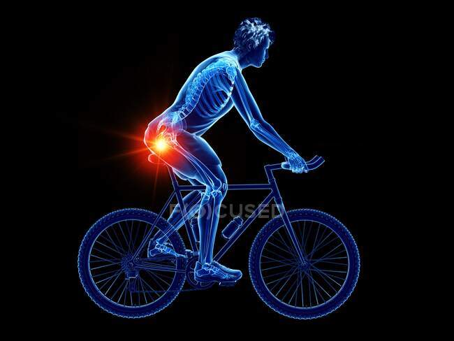 Esqueleto del ciclista con dolor en el cóccix, ilustración por ordenador - foto de stock