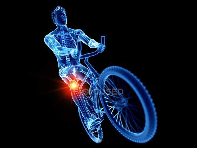 Esqueleto del ciclista con dolor en el cóccix, ilustración por ordenador - foto de stock