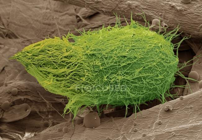 Colored scanning electron micrograph of predatory ciliate protozoan Loxophyllum. — Stock Photo