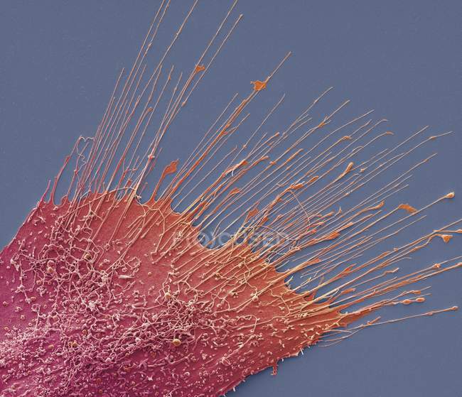 Micrografia eletrônica de varredura colorida de células de câncer ósseo de osteossarcoma . — Fotografia de Stock