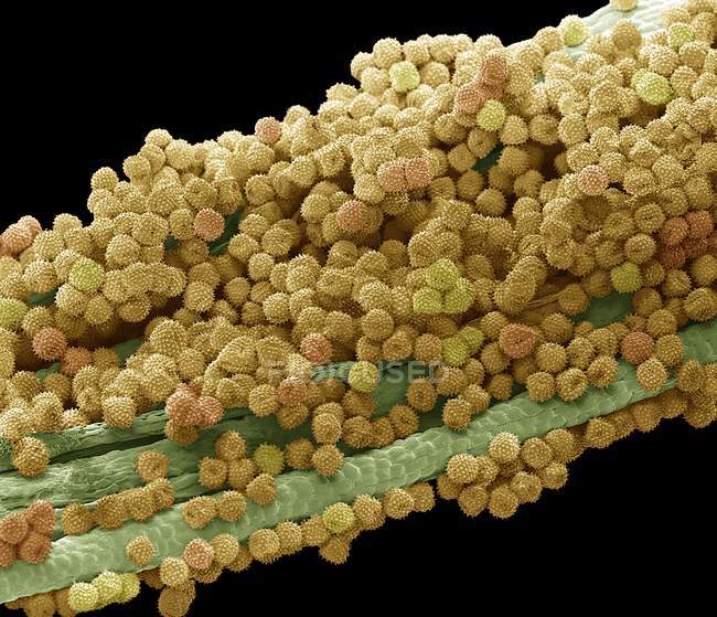Farbige Rasterelektronenmikroskopie von Pollenkörnern aus der Ringelblume. — Stockfoto