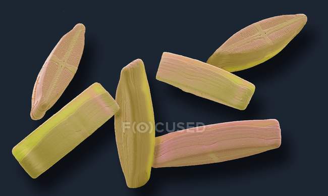 Micrógrafo electrónico de barrido coloreado de algas monocelulares fotosintéticas de diatomeas . - foto de stock